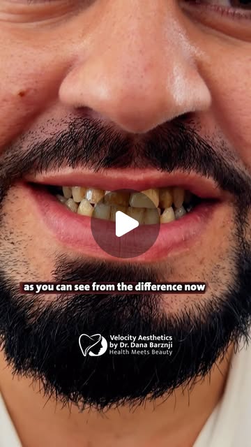 Dental Consultation